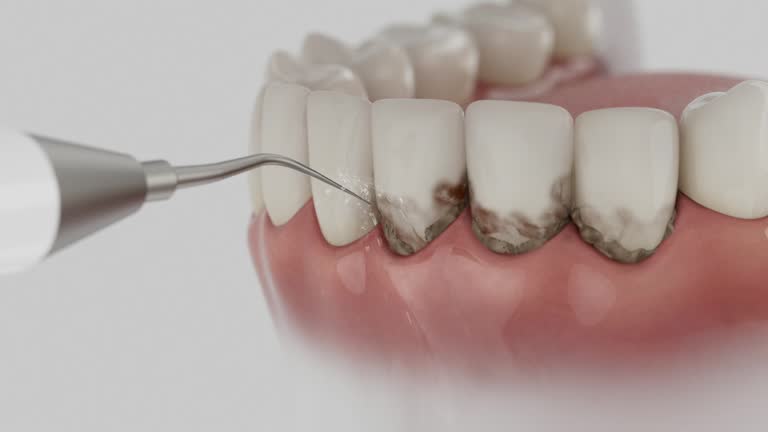Reliable Dental contractor in Fulton County County, IN by Dentist Open Now
